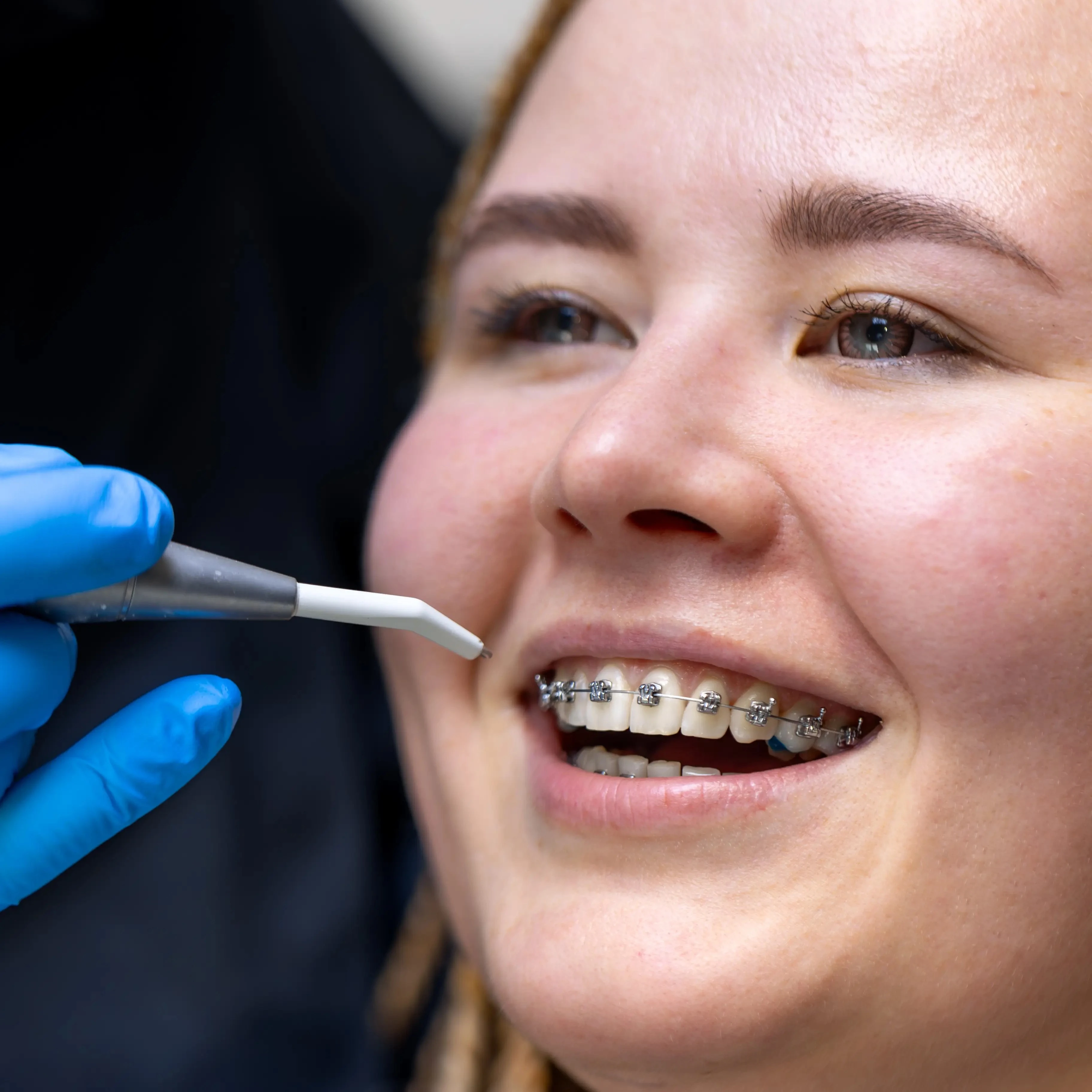 Why Choose Dr. Aburas Dental Center