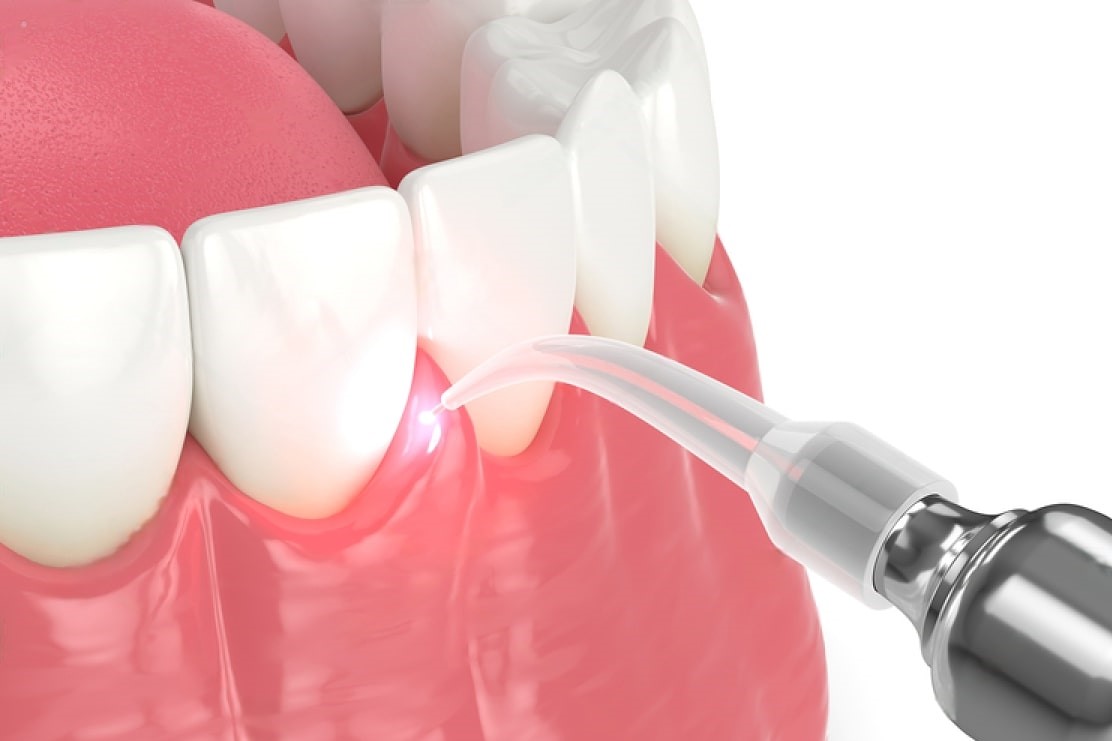 Ready to Transform Your Smile?