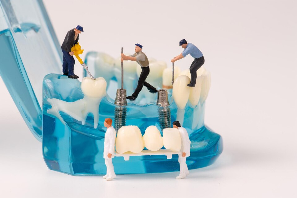 Do Dental Implants Hurt?
