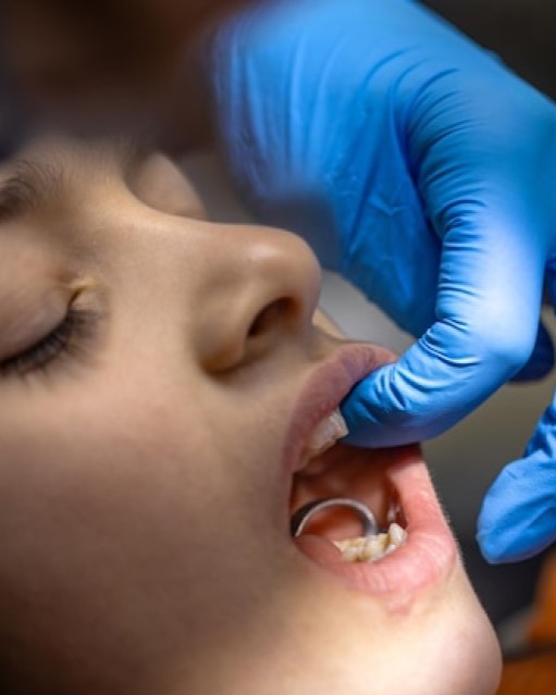 About Bone Grafting and Sinus Lift Surgery