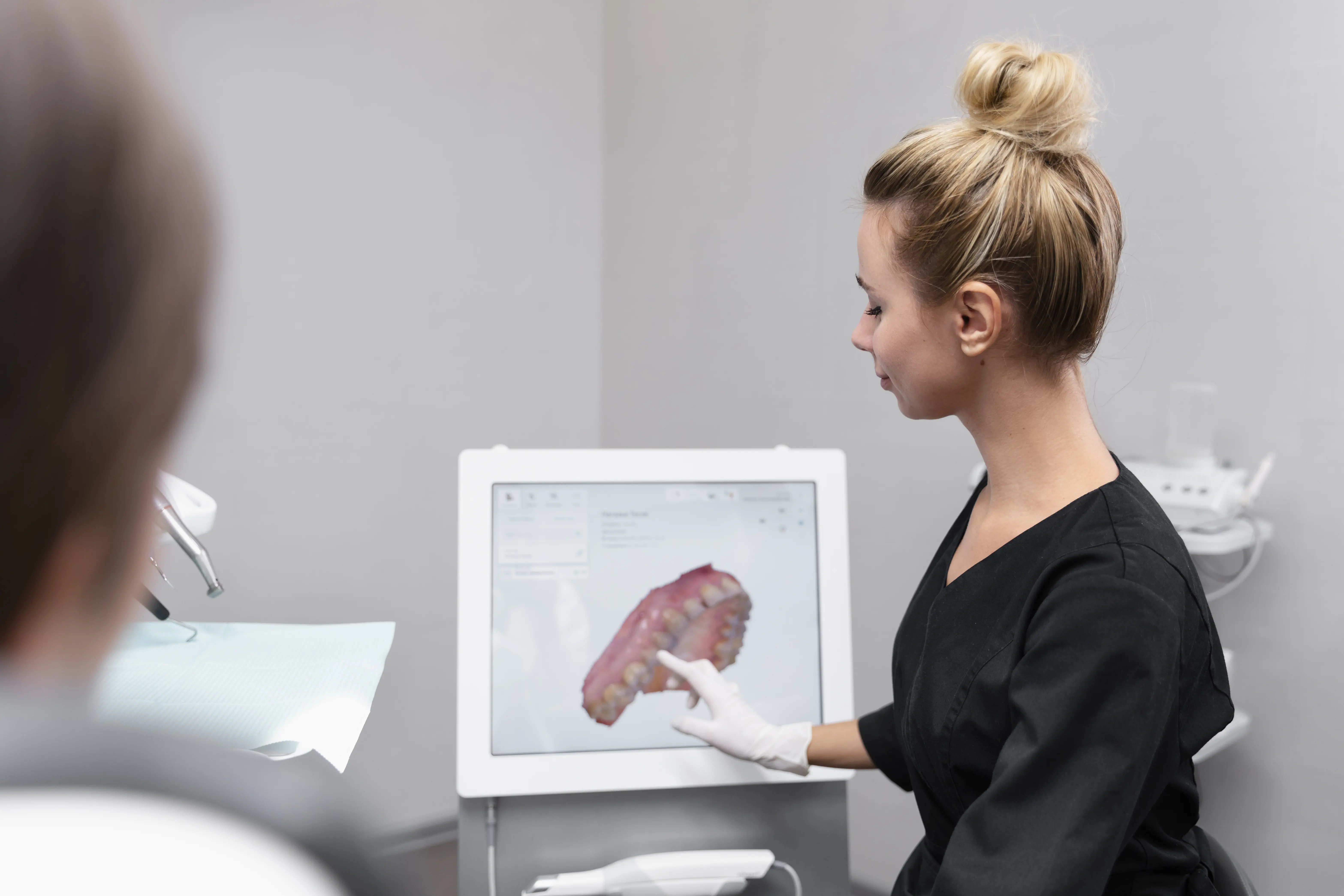 Dental Digital Scan