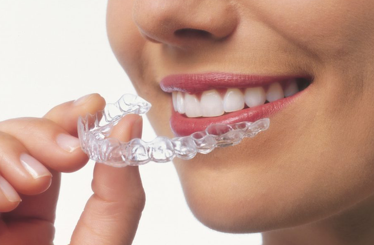 Clear aligners for adults: Why it's never too late to get a perfect smile